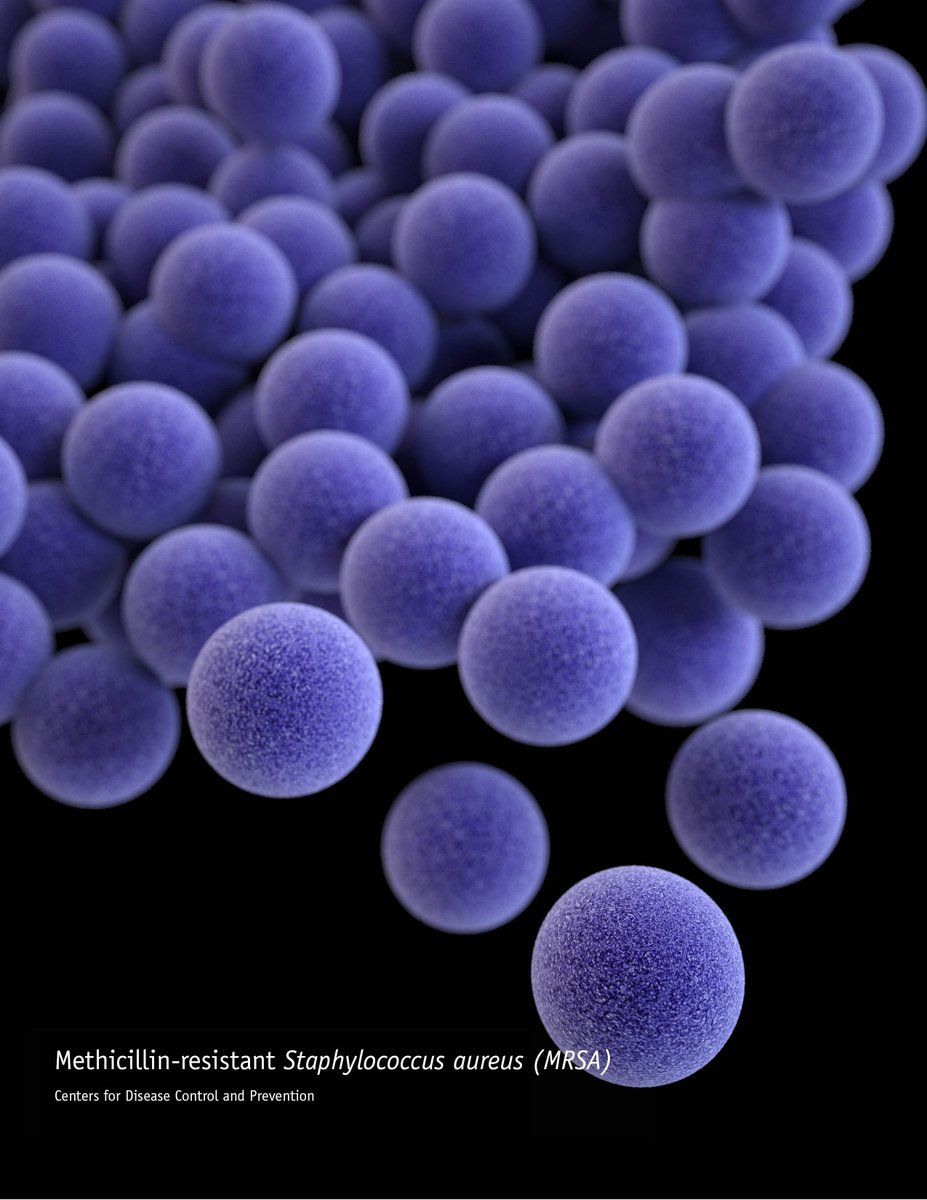 MSUChem's tweet photo. With antibiotic resistance on the rise, researchers like 
MSU's @Xuefei_lab are leading the fight to expand vaccine science.

The team's latest breakthrough in developing a bacterial vaccine for staph and MRSA is published today in @NatureComms!

https://t.co/DMzS51njtD https://t.co/Xy7WXyb0i9