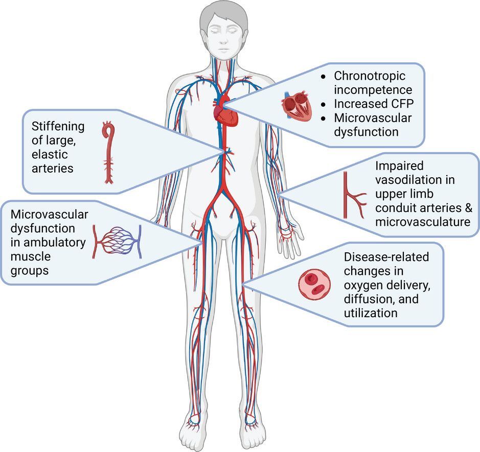 A #Review article from @K_Bunsawat, @UVRLphysiology (@UofUInternalMed), Nelson (@UTAkine) & Hearon Jr (@UTSWMedCenter) discusses causes, consequences & the journey towards a cure for exercise intolerance in heart failure with preserved ejection fraction! 📜buff.ly/49PSKxE