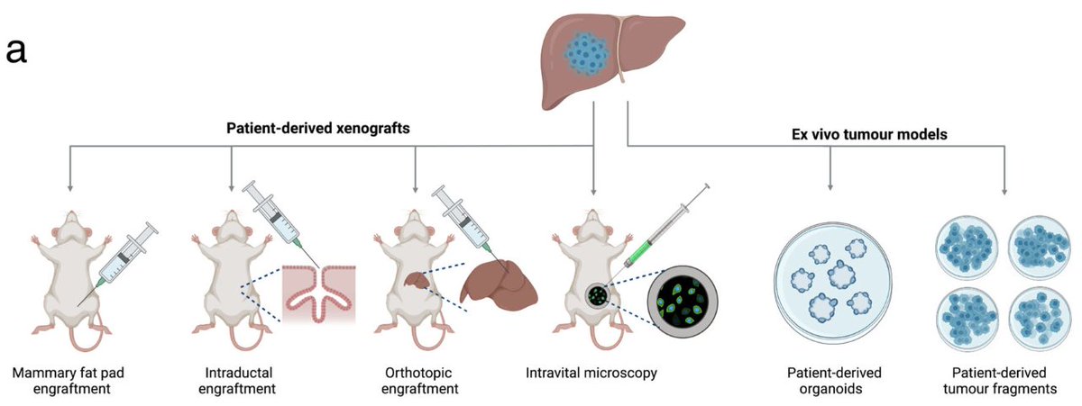 Christine Desmedt (@christinedesme2) on Twitter photo This program represents a unique opportunity to generate experimental models, also for patients with #lobular breast cancer and rare subtypes. 🙏 <a href="/PWBDerksen/">Patrick WB Derksen</a> @CBrisken <a href="/sflomos/">George Sflomos</a> <a href="/thommen_ds/">Thommen Lab</a> <a href="/ColindaScheele/">Colinda Scheele</a> <a href="/LeucciLRCB/">Eleonora Leucci</a> This program represents a unique opportunity to generate experimental models, also for patients with #lobular breast cancer and rare subtypes. 🙏 <a href="/PWBDerksen/">Patrick WB Derksen</a> @CBrisken <a href="/sflomos/">George Sflomos</a> <a href="/thommen_ds/">Thommen Lab</a> <a href="/ColindaScheele/">Colinda Scheele</a> <a href="/LeucciLRCB/">Eleonora Leucci</a>