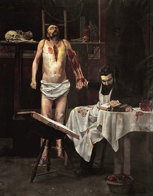 Professor Poirier with a dissected cadaver, 1886, by Georges Chicotot