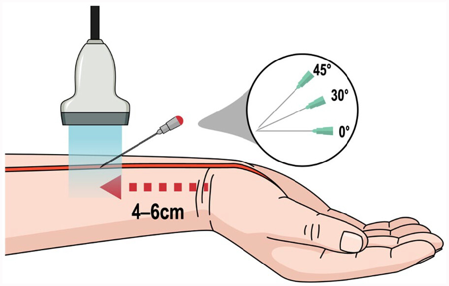NephroPOCUS tweet media