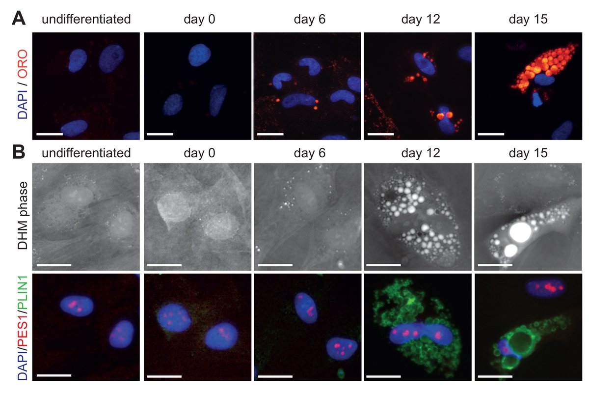 LafontaineLab's tweet photo. (4/4) Digital Holographic Microscopy is a powerful means to detect #lipid droplets without staining, here is an example during adipose stem cell differentiation. Thank you @ChristianeZrbas and team!
https://t.co/MCGe9ejXXN
#membranebound https://t.co/5tHyKgZJ9y