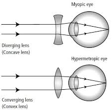 This month, AEV wants to teach you about refractive error, like near and far sighted, signs/symptoms, and treatment options! 👓 😇💜
#nearsighted #farsighted #angeleyesvision #AEV #memphis #jackson #tupelo #eyeexam #glasses #eyecare #contacts #optometricphysician #eyedoctor