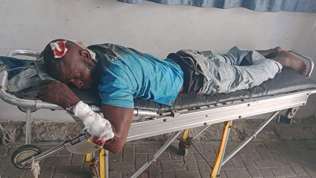 NEWS UPDATES 

His name is chibuzor nwokolo from Oji River he had an accident yesterday being Sunday here in Lagos at abulado bus stop pls in case you know him try to go to Navy Town hospital at satellite town close to alakija

Receiving treatment now @ Navy Town Hospital 🏥