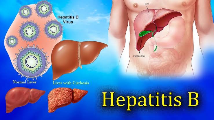 Facts about Hepatitis B

A thread 👇