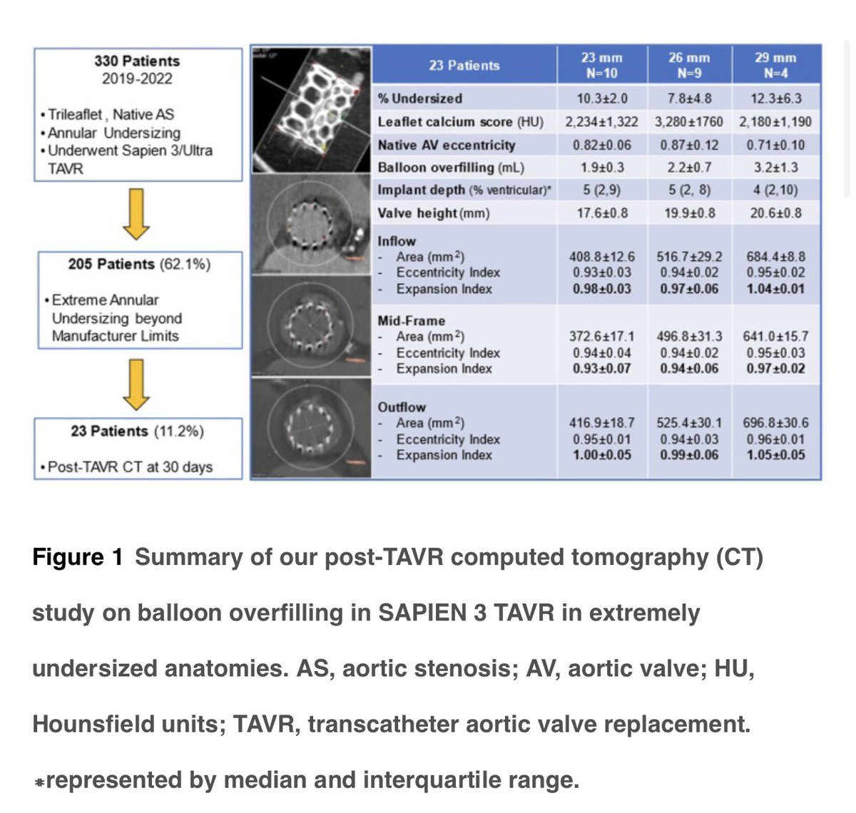 JUST OUT! Our @MyJSCAI @SCAI CT shows ++undersized S3 #TAVR ⬆️expansion to nominal. Better redo TAV feasibility too. Time to rethink S3 sizing chart? @Edwards_TAVR jscai.org/article/S2772-… @amrabbasmd @bapat_savrtavr @OKhaliqueMD @TheLADoctor @hahn_rt @modine_thomas @djc795