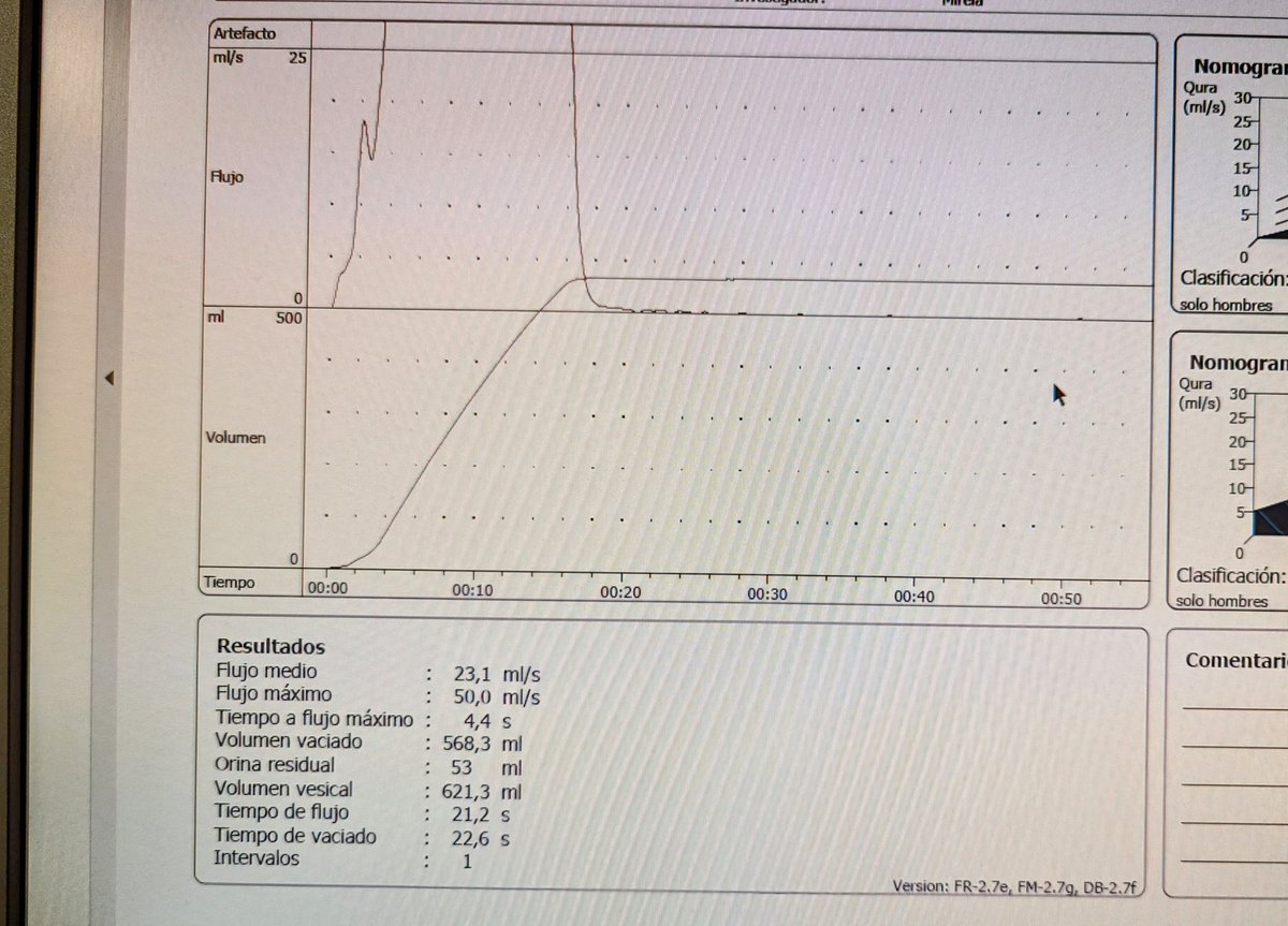 This is the uroflowmetry of a 90 yo patient (on warfarin) 1 year after #HoLEP . IPSS 0/0. Good continence. #Nevertooold for HoLEP. @FPuigvert