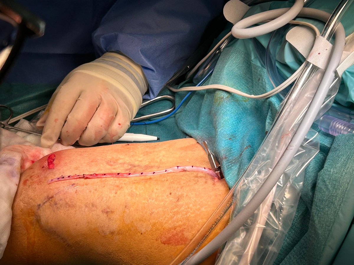 Dr Junjie Ng tweet media