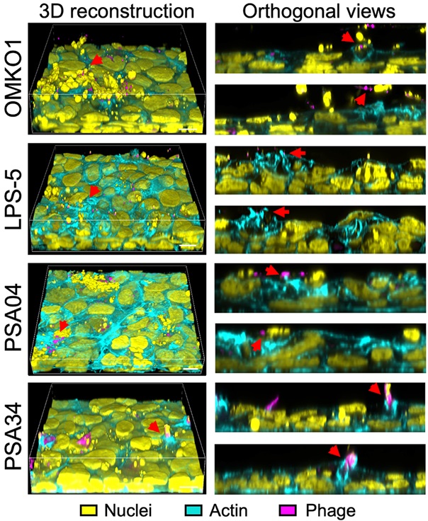 PLOSBiology's tweet photo. When considering #PhageTherapy, are there any direct effects of #phage on the human host? @jbombscientist &co show that therapeutic phages can be detected by human #RespiratoryTract epithelial cells & can elicit #proinflammatory responses. #PLOSBiology https://t.co/ANiM2olzFf https://t.co/8tOs6nKppP
