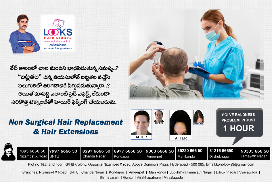 Non-Surgical Hair Replacement .. 100% Natural Looking, No Side effects. Nizampet X Road-70956666 50, JNTU-79976666 50 Kondapur- 8977 666650, Ameerpet-90636666 50, ChandaNagar-8297 6666 50 #nonsurgicalhairreplacement #hairreplacement #hairpatch #hairfixing #hairsystem #hairbonding