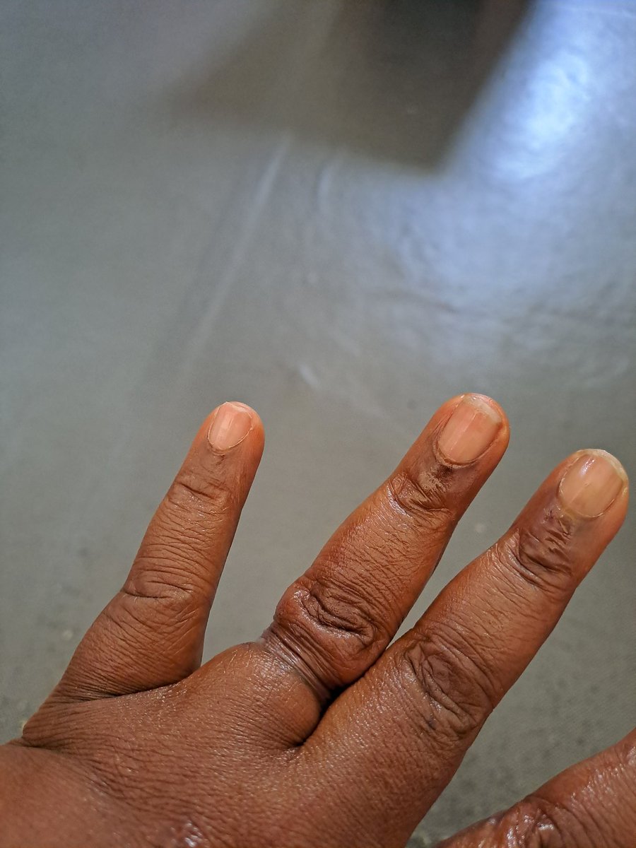 In a quest to not loss or misplace wedding ring😭😭. Thank God my son came to my rescue this morning. Na only me do wedding? Abeg. Will complete 24hrs today without it. First time since 16yrs