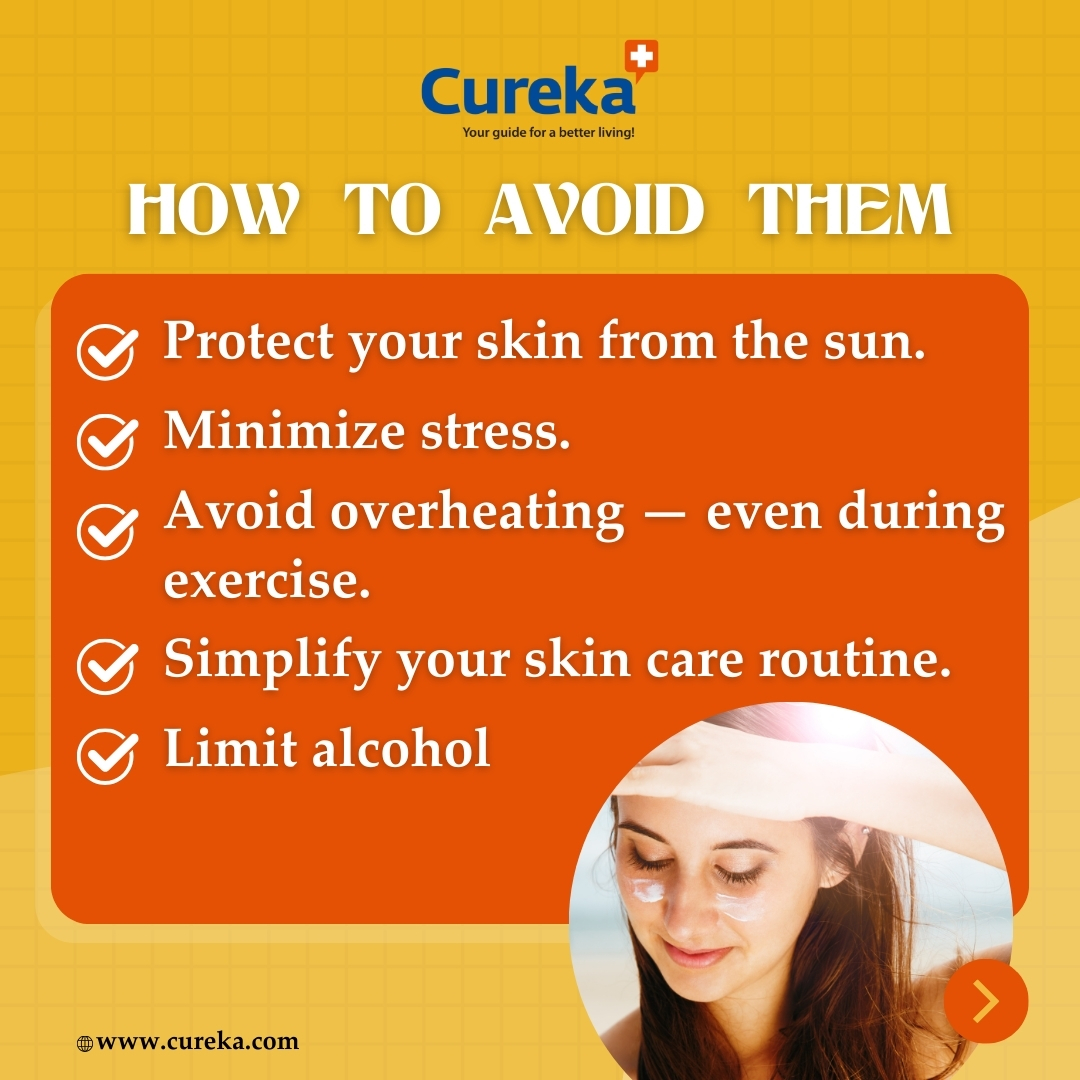 'Rosacea triggers include spicy foods, alcohol, stress, and sun exposure. To avoid flare-ups, it's important to protect skin from the sun, and manage stress levels through relaxation techniques.' 
#Cureka #flipkart #Wedjat #wellbeing #immunesystem
#healthylifestyle #immunebooster