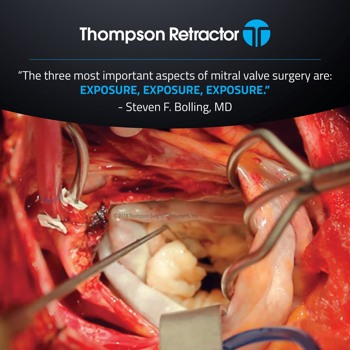 “The three most important aspects of mitral valve surgery are: EXPOSURE, EXPOSURE, EXPOSURE.” - Steven F. Bolling, MD.
#cardiothoracicsurgery #cardiothoracicsurgeon #mitralvalve #thompsonretractor