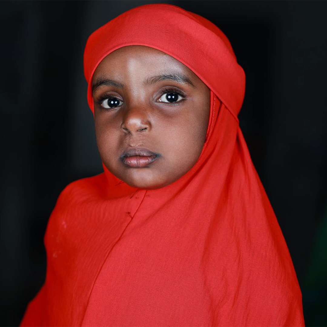 Meet Umul from Somalia! She was born with a cleft, but thanks to Smile Train's local partner, Bela Risu Foundation, she received free cleft surgery and comprehensive care. Umul is now thriving, and her mother is advocating for cleft awareness. #SmileTrain