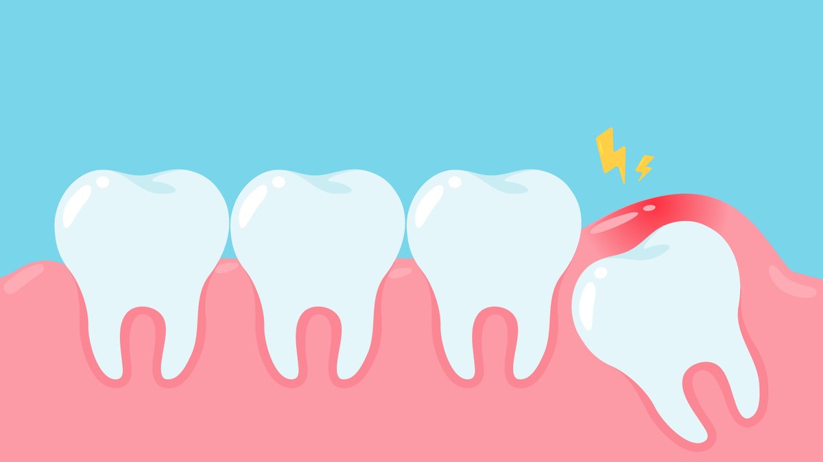 👀 Curious about wisdom teeth removal? From signs to surgery, learn everything here! Visit ➡️ bit.ly/3vY5jJg #HealthSmiles #ToothExtraction