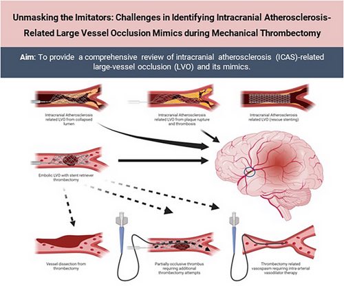 Unmasking the Imitators: Challenges in Identifying Intracranial Atherosclerosis‐Related Large Vessel Occlusion Mimics During Mechanical Thrombectomy | Stroke: Vascular and Interventional Neurology ahajournals.org/doi/10.1161/SV… @StrokeAHA_ASA @SVINJournal @svinsociety