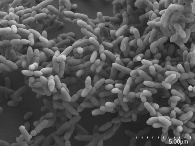 biodipia's tweet photo. O que la levadura (hongo unicelular) contenida en una #cerveza tiene unos genes más parecidos a los nuestros que a los de una arquea, aunque ambos sean organismos unicelulares que no se pueden ver a simple vista. https://t.co/2zD2HNdBQr