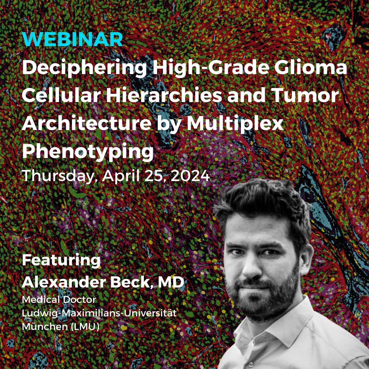 Don't forget to register for our webinar tomorrow to learn what #multiplex cell phenotyping tells us about malignant #braintumors! This webinar will take place twice on April 25: ✔️ Europe Time bit.ly/4ayN7oA ✔️ North America Time bit.ly/49yTfw2 #gliomas
