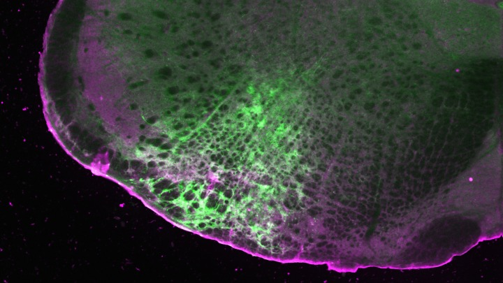 A @UMichResearch team has developed a chemical tool to detect how signaling molecules travel within the brain to reach and interact with GPCRs in mice. The new tool can detect molecules across brain regions without sacrificing spatial resolution. news.umich.edu/chemical-tool-…