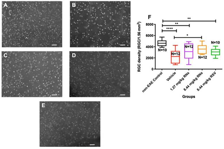 Intranasal resveratrol nanoparticles enhanced neuroprotection in a mouse model of multiple sclerosis.

#NEIfunded work from @UCLeye @imperialcollege @PennMedicine @ScheieEye: finding a potential low-dose option to treat optic neuritis.

@IJMS_MDPI: bit.ly/3xKSh2v