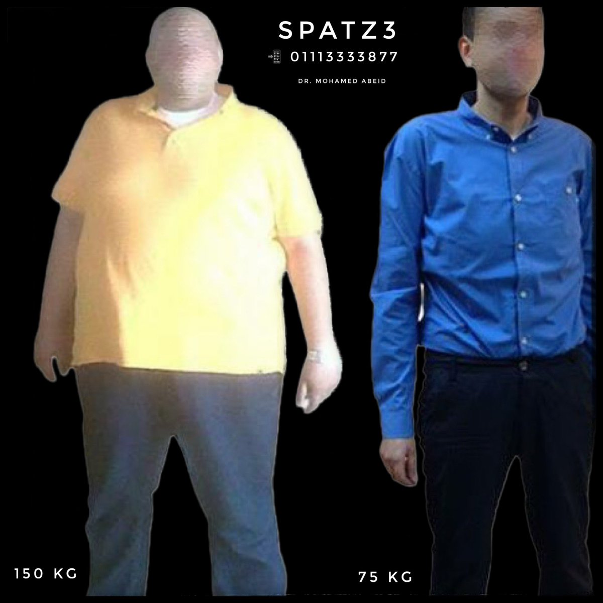 MohamedAbeid's tweet photo. 100 % EWL
50 % TWL
Only with #SPATZ3, the best #WeightLoss solution!! https://t.co/9gr51o1zPp