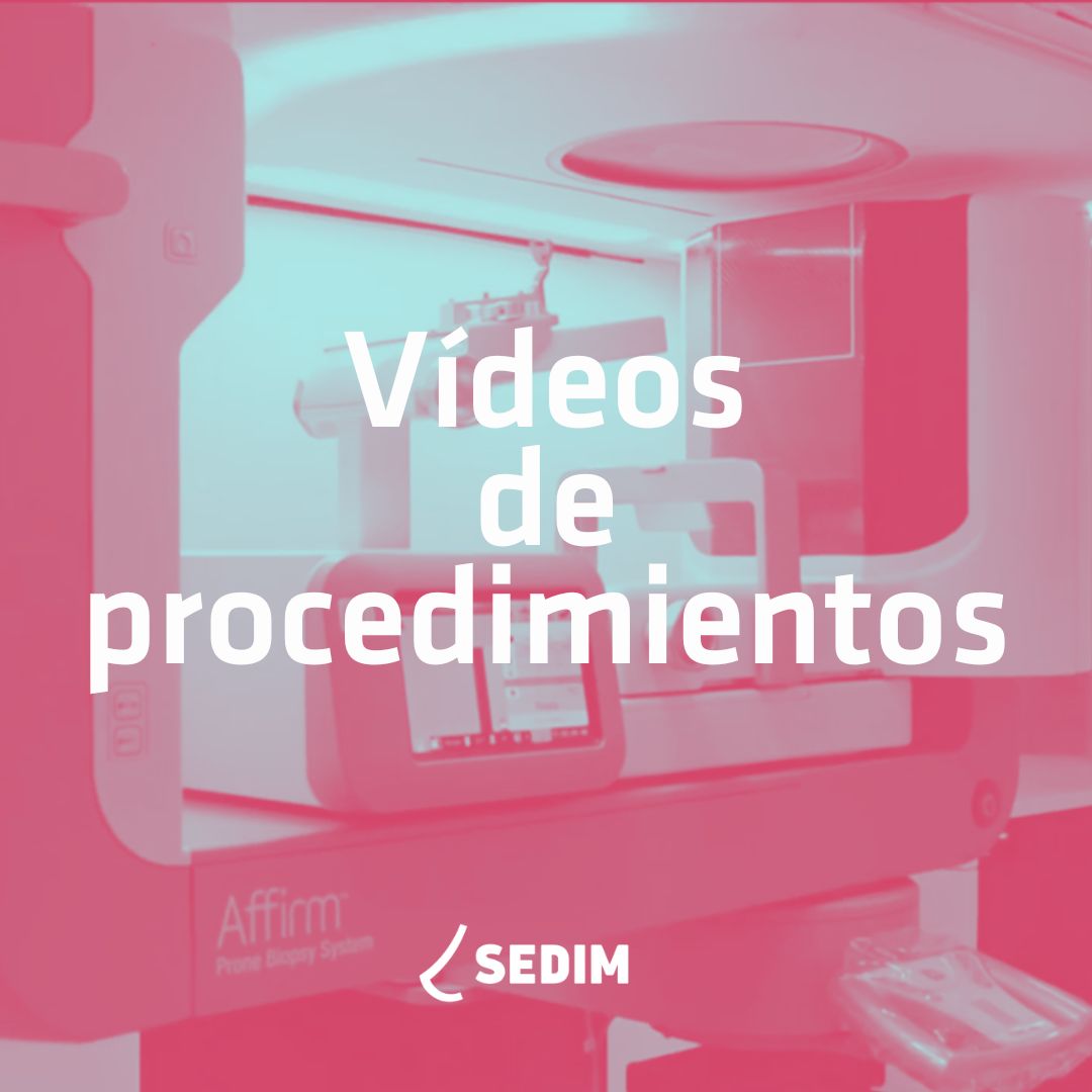 💻📚 Entre los recursos formativos de la web de #SEDIM ofrecemos vídeos de procedimientos que aportan una mayor comprensión sobre técnicas como la biopsia de mama con RM, PAAF o BAG. ¿Quieres ver cómo se realizan? 👀 sedim.es/d-videos-de-pr…