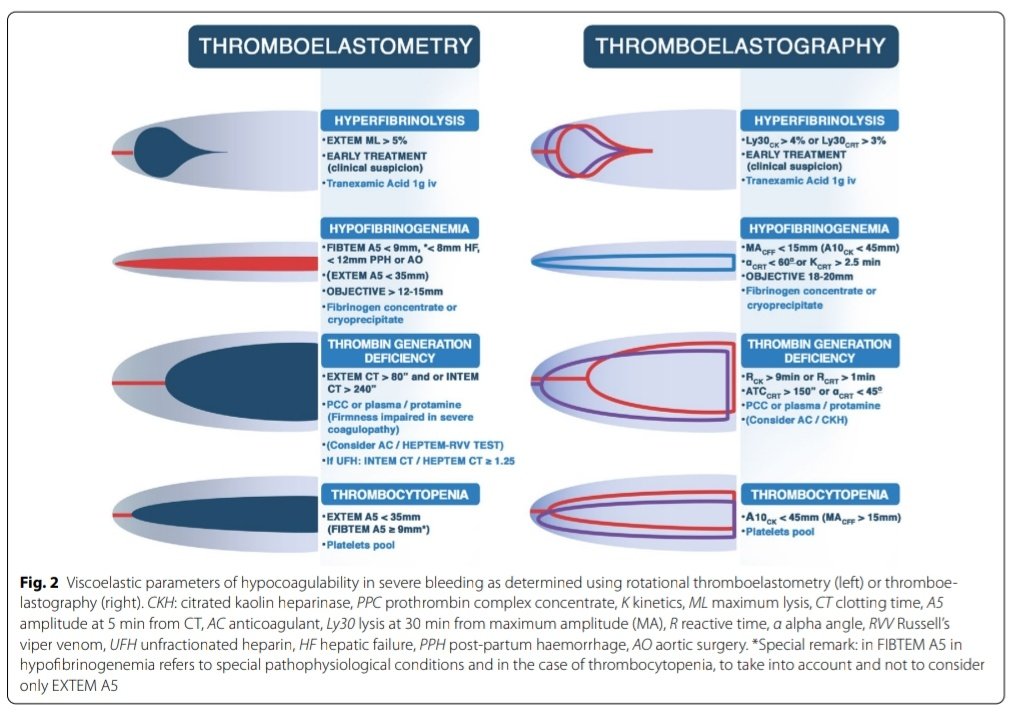 Leo_Santo5's tweet image. 💎Manejo Contemporáneo de la Hemorragia Grave en Cuidados Críticos 🩸🏥

🧐 Definición
🤯Fisiopatología
🩺Escenarios Clinicos
⚕️Diagnóstico
📖Protocolos
🆎Transfusión masiva

🔰📚Intensive Care Med

doi.org/10.1007/s00134…

Artículo Completo 👇🏻✅🆓t.me/SoMELaguna