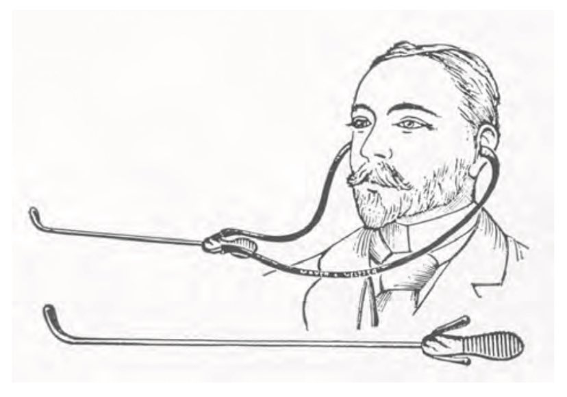 Une vessie ça s’écoute ! L’éphémère Lithoscope avait été inventé pour diagnostiquer les calculs vésicaux à l’auscultation (Historia Urologiae Europaeae)