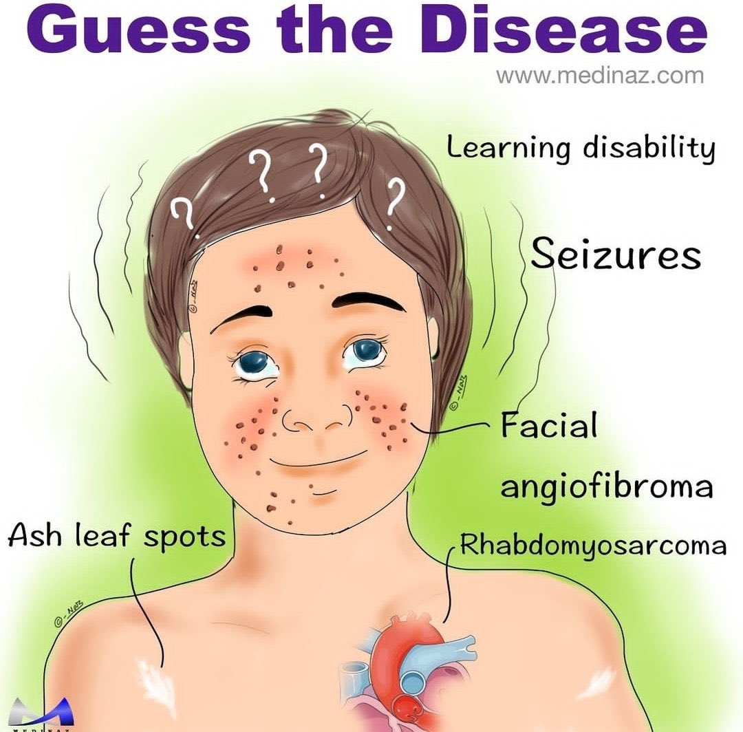 Diagnosis? H/t: @Neuromed_ Credit: Medinaz.com #MedEd #MedX