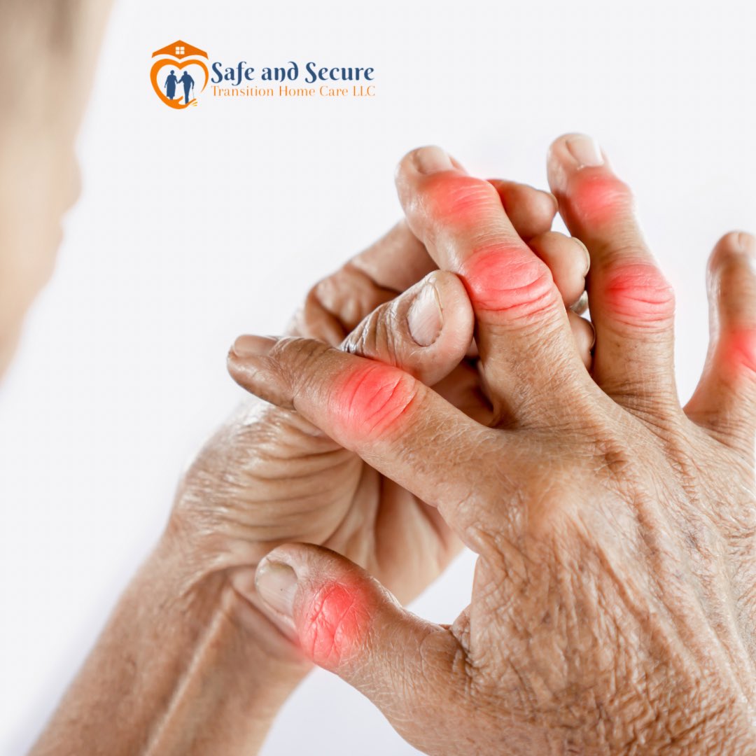 Arthritis affects nearly a quarter of all adults in the U.S., and there is great variability in how it may impact day-to-day life.  It can affect any joint, but the ones that give older adults the most problems are the knees, hands, wrists, and hips.🩻

#SeniorCare #NorthernVa