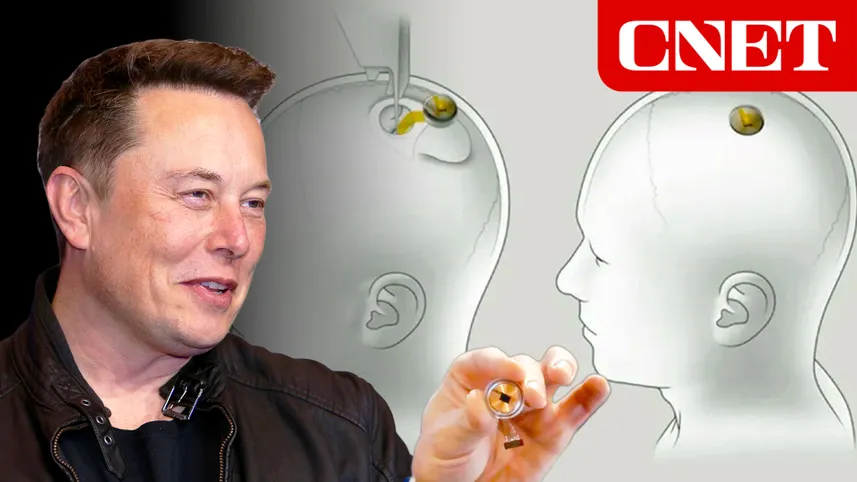 Bullshit, Alex! Elon Musk literally created the mind virus machine. You must think Musk's ass is a lollipop the way you lick it.