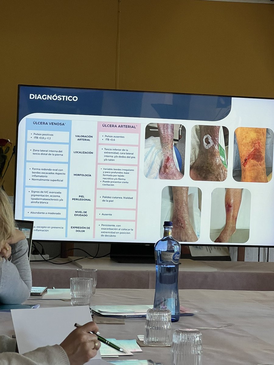 silvia_mercade's tweet photo. “Derribando barreras de compresión”curs impartit per la ponent Nuria Serra,Infermera experta en proves de diagnòstic no invasives.#infermeria #compressio #curesinfermeres #urgo @UrgoMedical_es #atencioprimaria #infermera https://t.co/J13CddKsjE