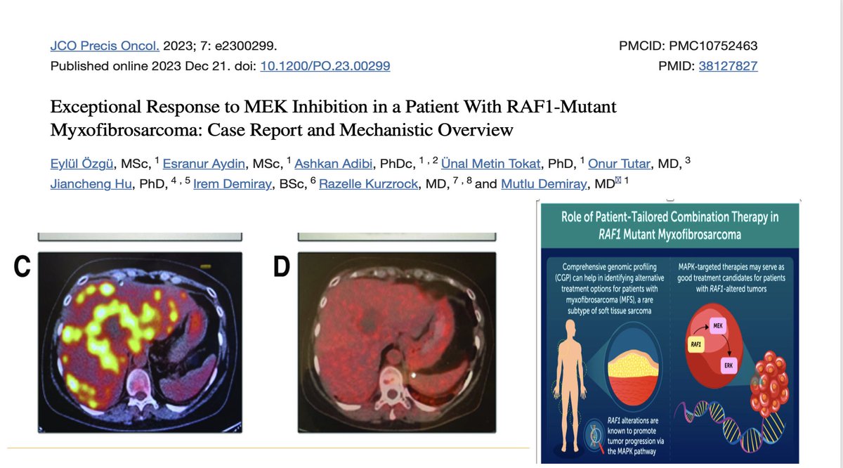 Hitting the targets— N-of-1🎯🎯
Can’t get over this beautiful complete remission by Demiray group.  🔥🔥Customized combination with trametinib (MEK) inhibitor and palbociclib (cdk4/6 inhibitor) for aggressive myxofibrosarxoma with RAF1 and cyclin  alterations.