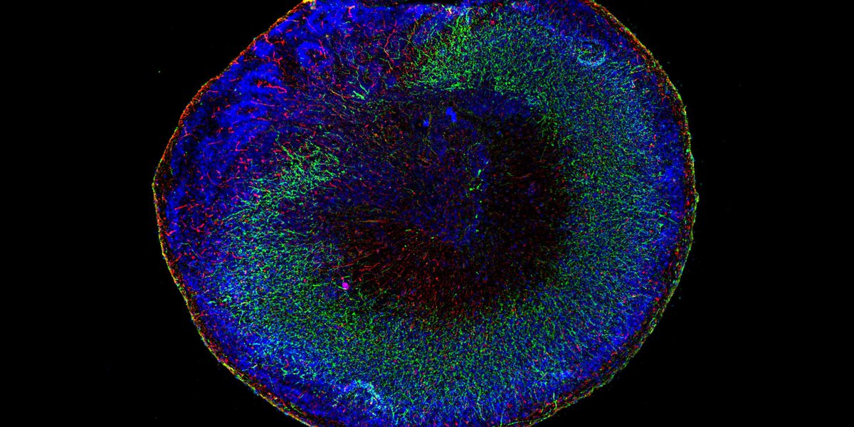 Et demain 16h ? Reproduire des organes miniatures pour les étudier in vitro , c'est la promesse des organoïdes... sur puces, qui reproduisent les forces et écoulements de fluides du corps humain. Quelles sont les applications médicales de ces organes sur puces ?