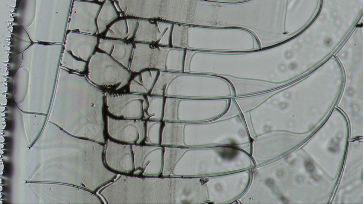 This was from a Pfizer vial sample, seen under the microscope, after three days of air drying And you wonder why people are getting heart attacks, strokes, turbo cancers from the #C19 bioweapon injections?!