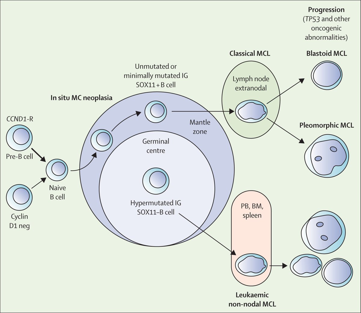 B-cell non-Hodgkin lymphomas are a group of malignancies that can affect any organ in the body. In a Seminar, authors summarise current knowledge & standard of care for B-NHL, & highlight new findings in the molecular background of disease development: hubs.ly/Q02tTzNQ0