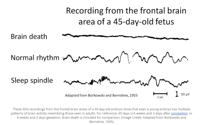 Vixen95Trish's tweet photo. A fetus has no brain activity, claims the guy who says I am not following the science.
1955. Brain activity at 8 weeks. https://t.co/i524sqY3Jz
