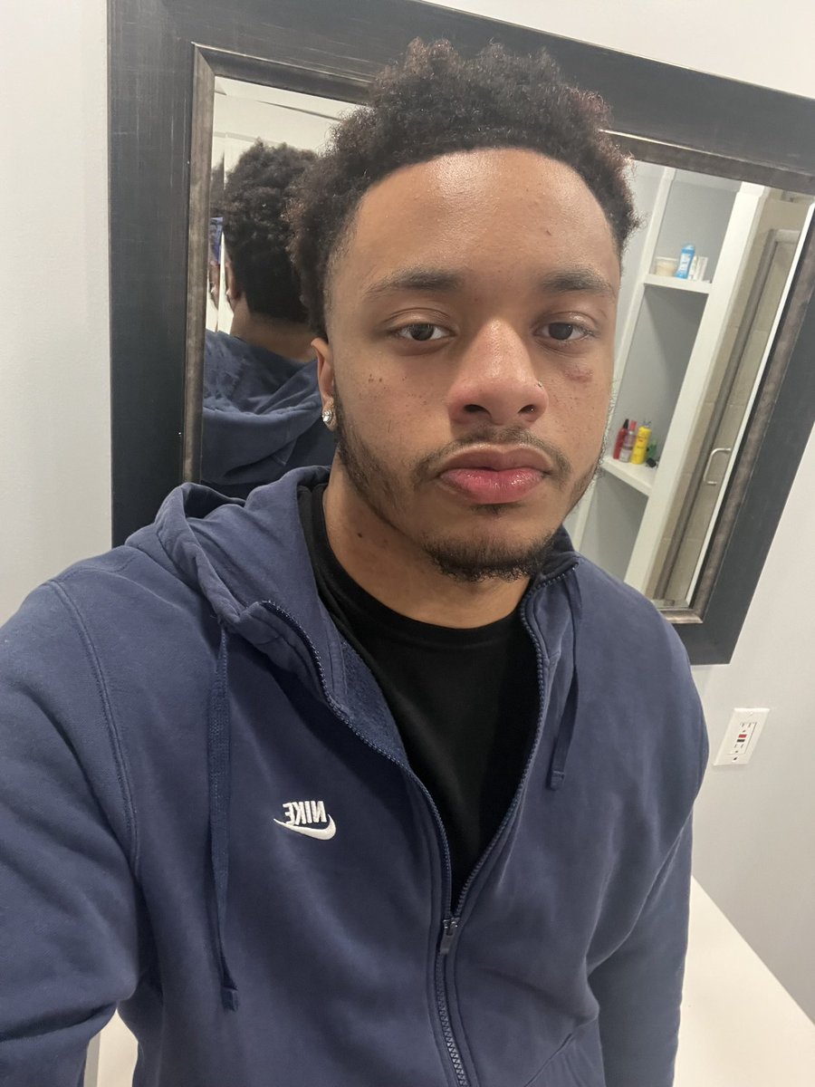heynowsarchive's tweet photo. Do I look worse with no locs?? https://t.co/ATEsAHODqa