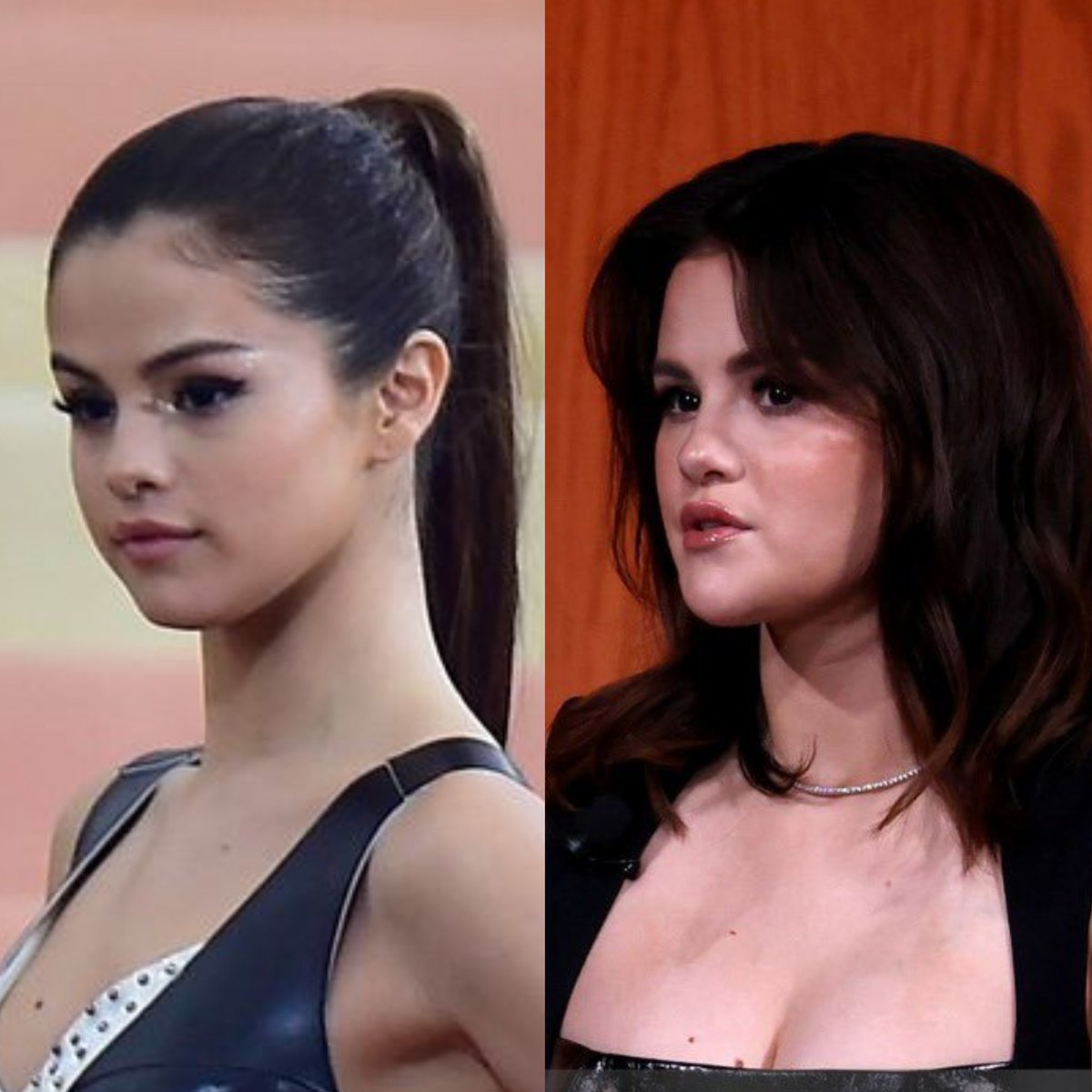 Selena Gomez shows the results of her bichectomy.