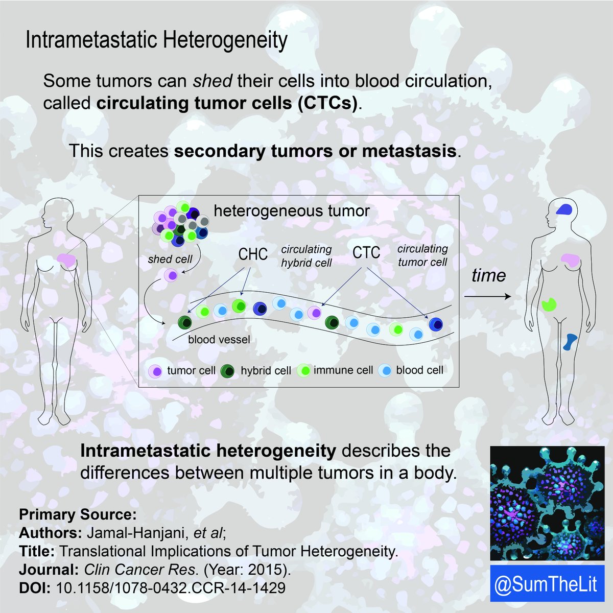 SumTheLit's tweet photo. Why might two patients, both diagnosed with triple negative breast cancer (TNBC), respond differently to the same treatment? 🩻🩺🫀🫁🧠

Tumor heterogeneity is an explanation.

#sumthelit #cancer #tumor #drugtreatment #science #medicine #biology https://t.co/OWIrwm8lJ8