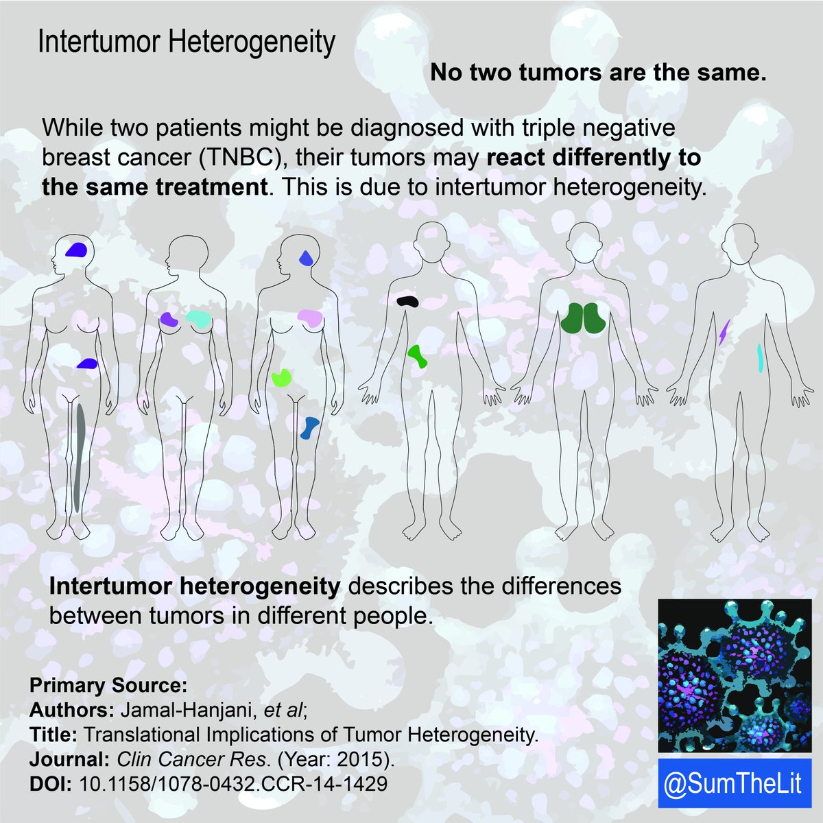 SumTheLit's tweet photo. Why might two patients, both diagnosed with triple negative breast cancer (TNBC), respond differently to the same treatment? 🩻🩺🫀🫁🧠

Tumor heterogeneity is an explanation.

#sumthelit #cancer #tumor #drugtreatment #science #medicine #biology https://t.co/OWIrwm8lJ8
