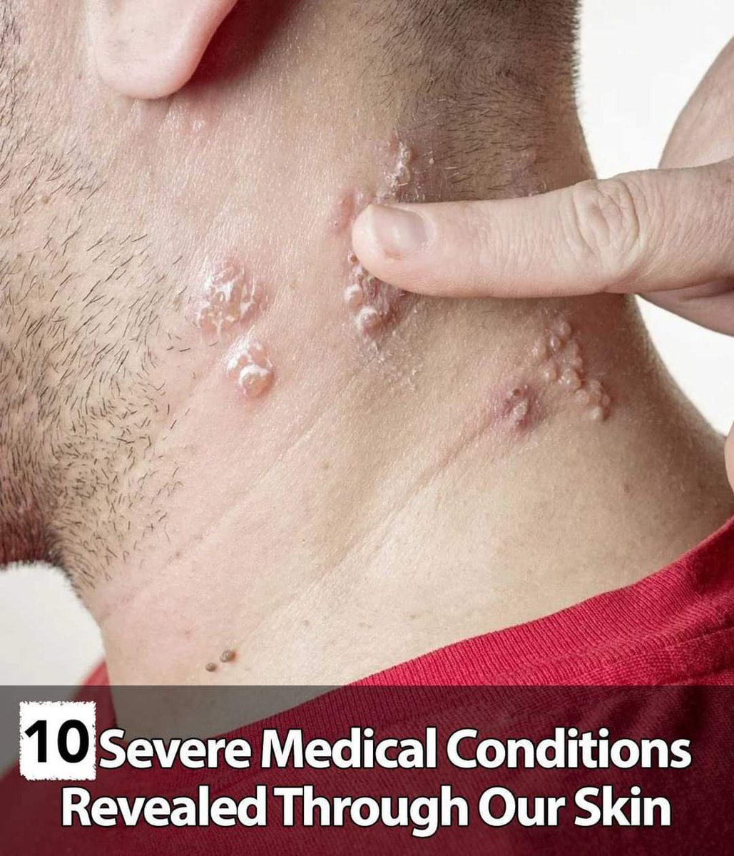 The skin signals diseases and medical conditions requiring an immediate visit to the doctor. 🧐