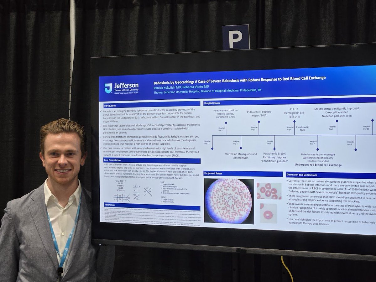 CalBear5's tweet photo. The final @TJUHospital Med poster of #SHMConverge24 is a wild case report by Drs. Patrick Kukulich and Rebecca Vento using RBC exchange to treat severe babesiosis! Wowers! Heck of a closer! 🧵... https://t.co/eD8MF0xM96