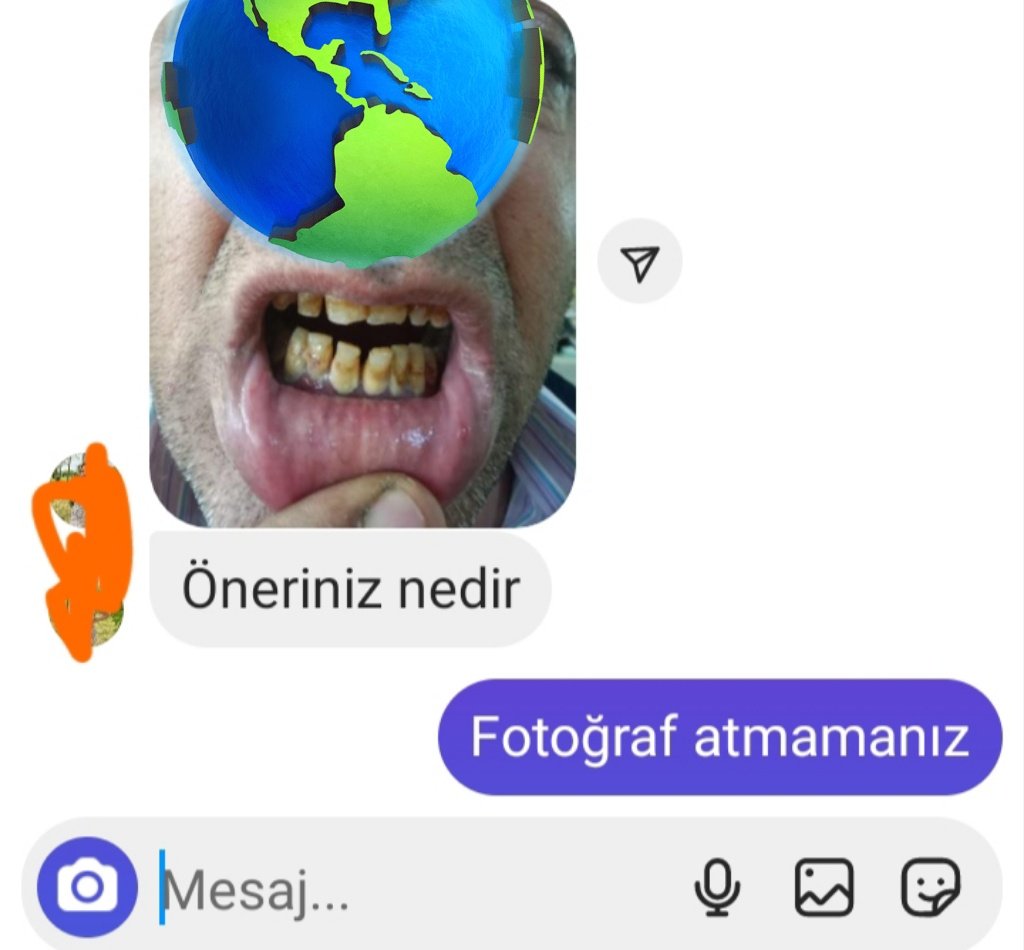 Abi şu tanımadığınız insanlara ananızın babanızın diş fotoğrafı atma işini bırakın bi aq mesaisi bitince bari salın şu insanları