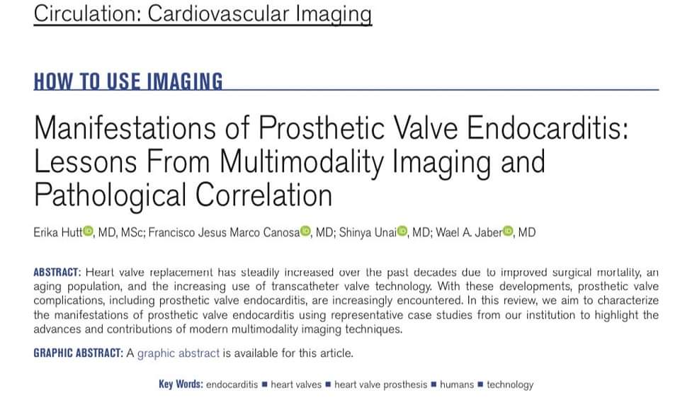 🔴 Manifestations of Prosthetic Valve Endocarditis: Lessons From Multimodality Imaging and Pathological Correlation @CircAHA

ahajournals.org/doi/10.1161/CI…
 #CardioEd #Cardiology #Echofirst #CVnuc #MedEd #CardioEd #Medical