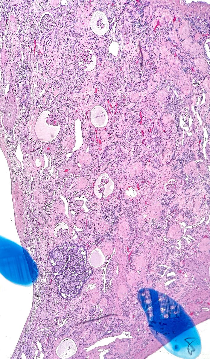 Jay "Thymocyte" Hwang tweet media