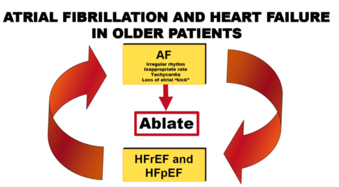 PRO/CON Debate: #AFib Ablation in Older Adults w/ #HFrEF The PRO portion of the PRO/CON debate between Drs. Brian Olshansky & @drjohnm presents a significant conundrum within the fields of #cvEP & geriatric cardiology. Read more: bit.ly/44v7K37