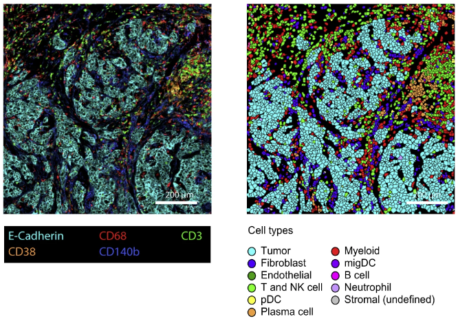 When exhaustion sets in, pushing through to finish the job can be tough. This couldn’t be more true than for #Tcells working to destroy a tumor… Read our #scienceblog highlighting a foundational study on T cell exhaustion as it applies to #breastcancer: go.standardbio.com/l/838373/2024-…