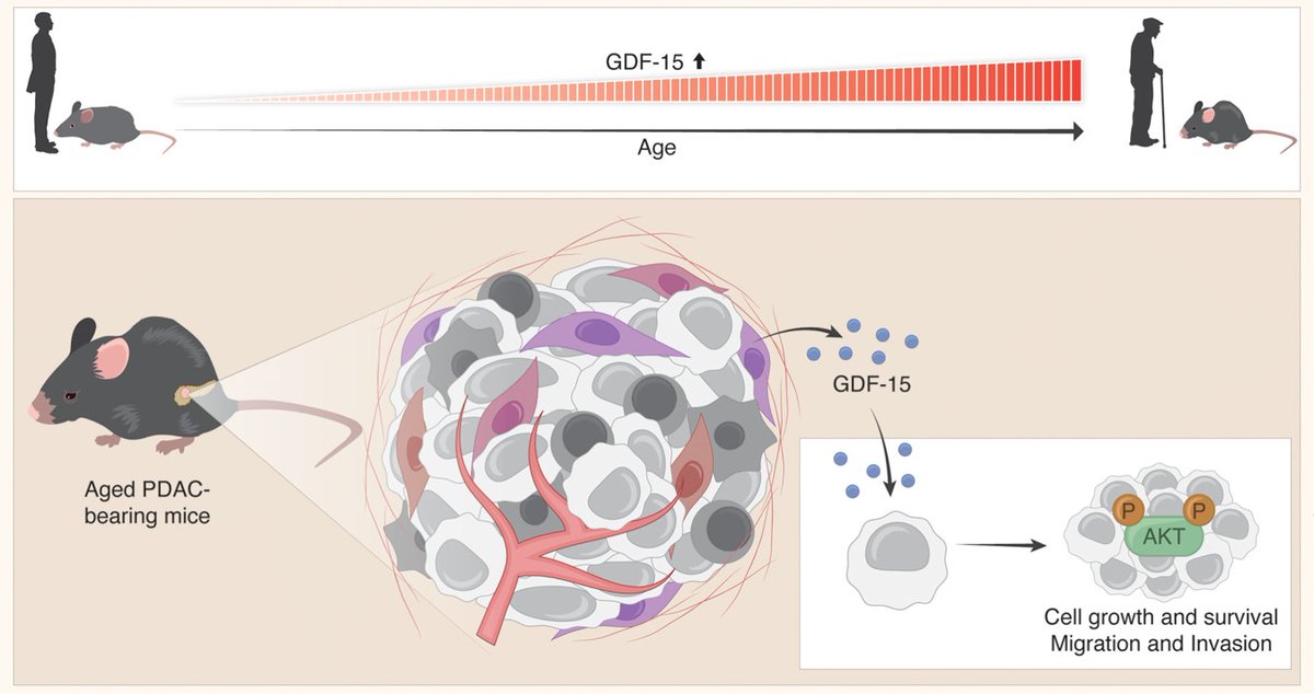 In the Spotlight— Unlocking the Role of Age-Related Changes to Fibroblasts in #PancreaticCancer, by @AchinoamIsaacs, @DebraBarki, and @shouval_lab. aacrjournals.org/cancerres/arti… @WeizmannScience