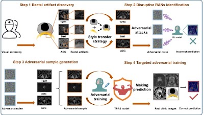 #DeepLearning for MRI #prostate cancer diagnosis doi.org/10.1148/ryai.2… @BiocLnkgnEcwEfT #MRI #AbdRad #TPAS